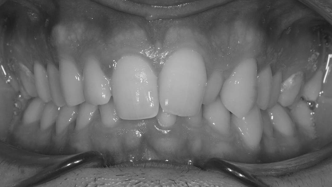 clinica olay dental pola de siero noreña asturias resultados pacientes