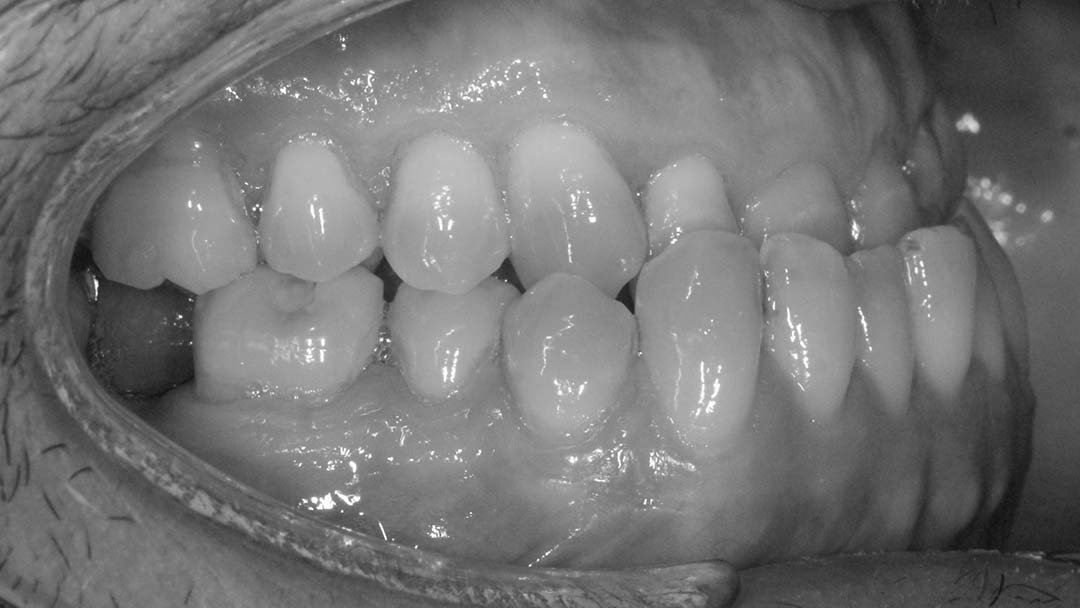clinica olay dental pola de siero noreña asturias resultados pacientes