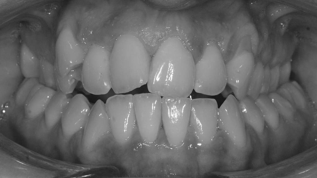 clinica olay dental pola de siero noreña asturias resultados pacientes