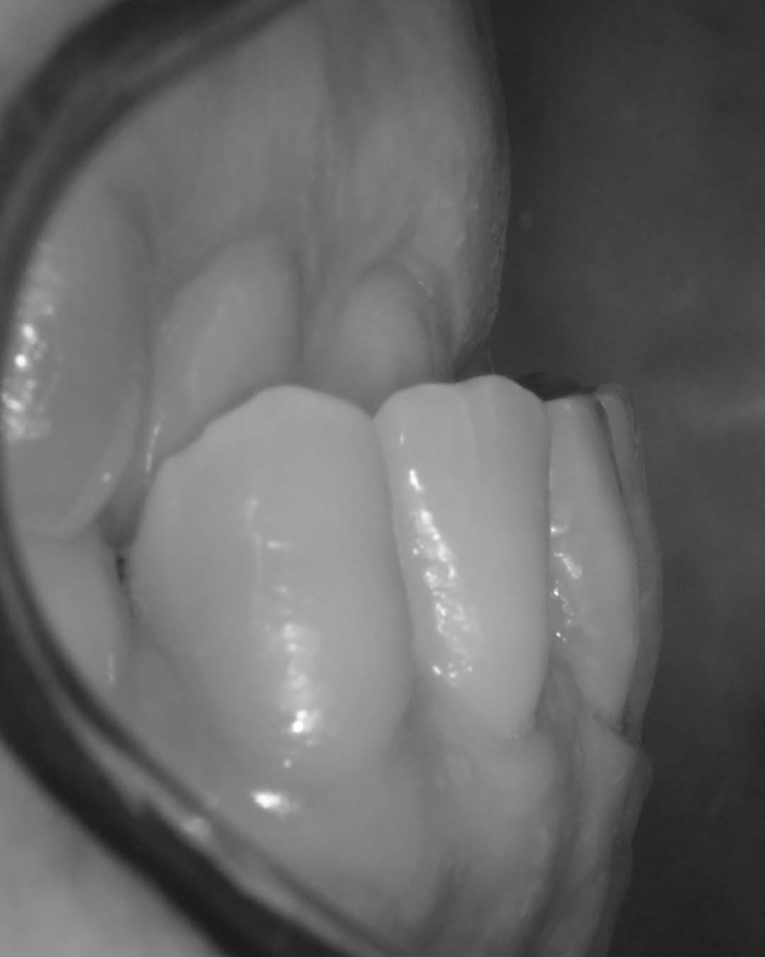 clinica olay dental pola de siero noreña asturias resultados pacientes