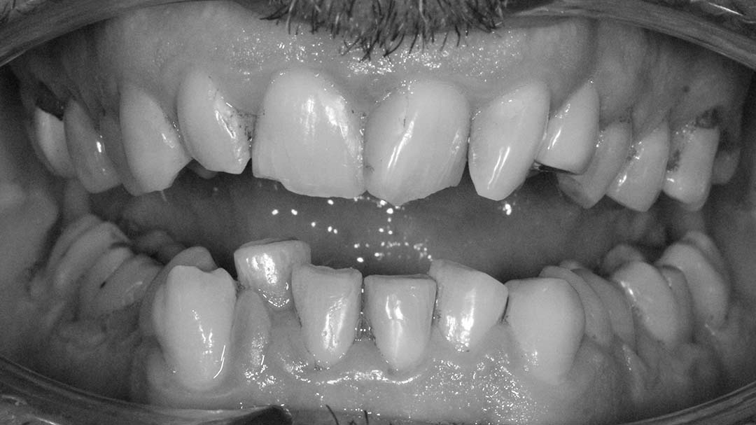clinica olay dental pola de siero noreña asturias resultados pacientes