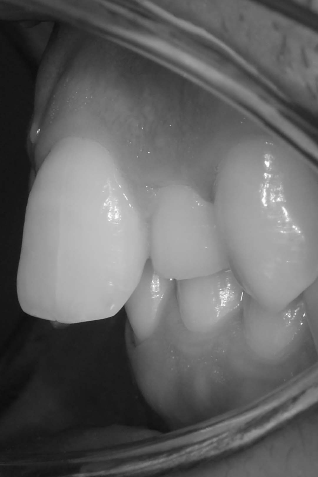 clinica olay dental pola de siero noreña asturias resultados pacientes