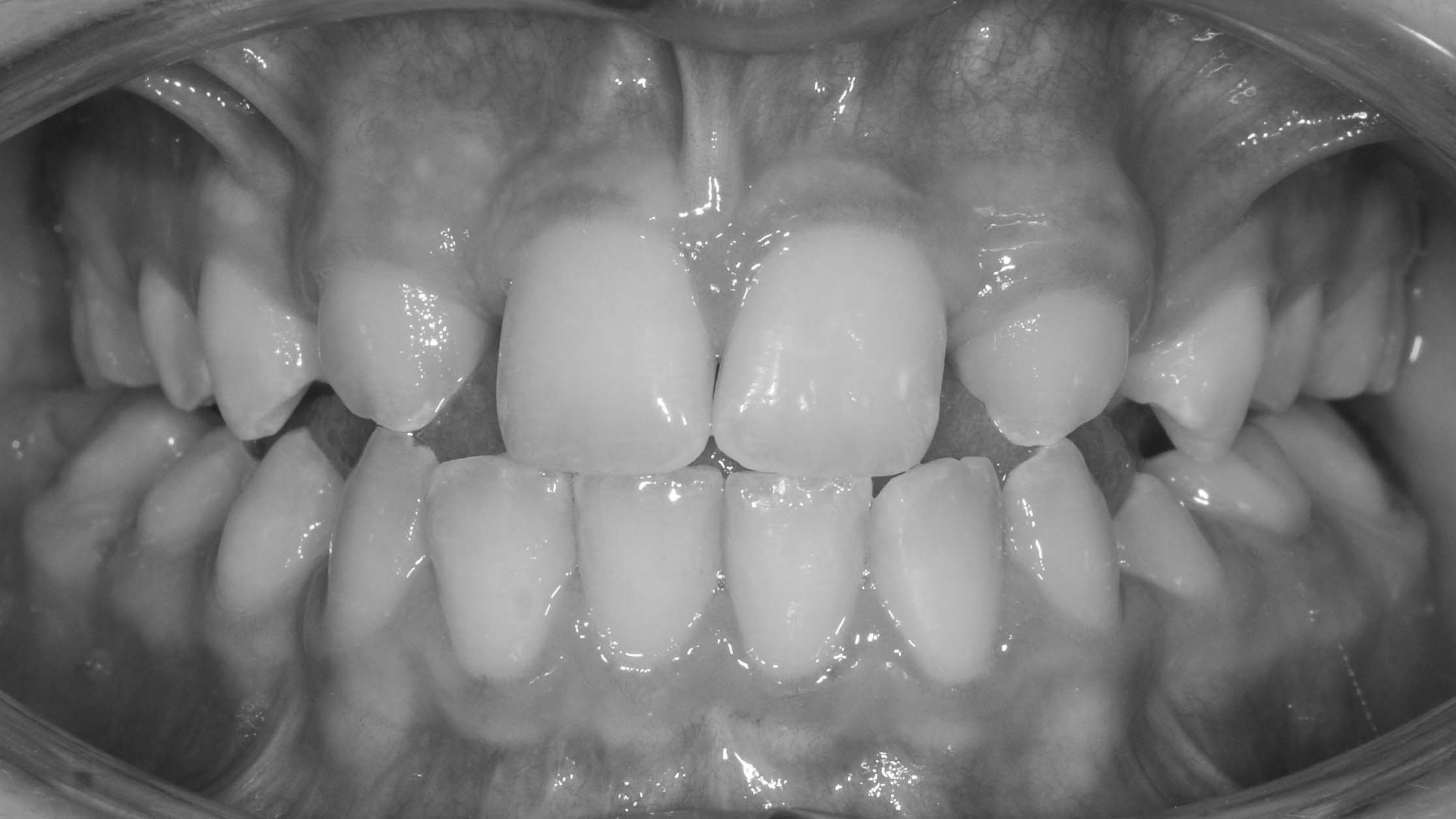 clinica olay dental pola de siero noreña asturias resultados pacientes