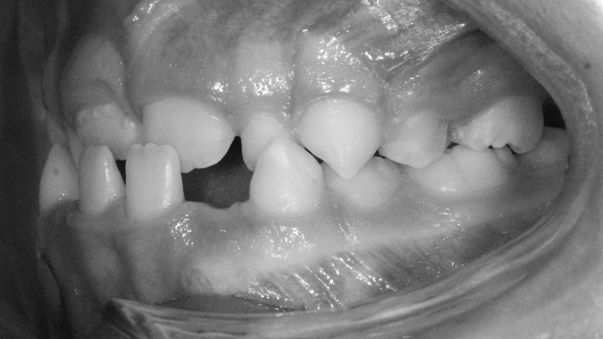 clinica olay dental pola de siero noreña asturias resultados pacientes