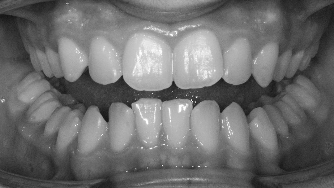 clinica olay dental pola de siero noreña asturias resultados pacientes