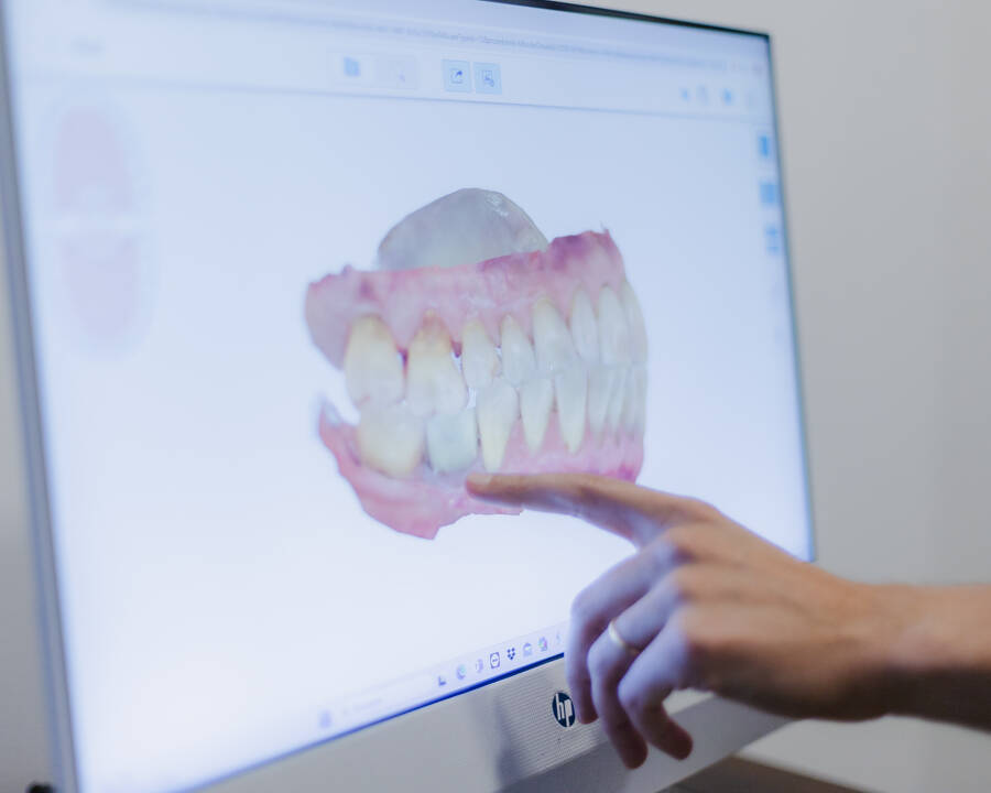 clinica olay dental pola de siero nore&ntilde;a asturias tecnica