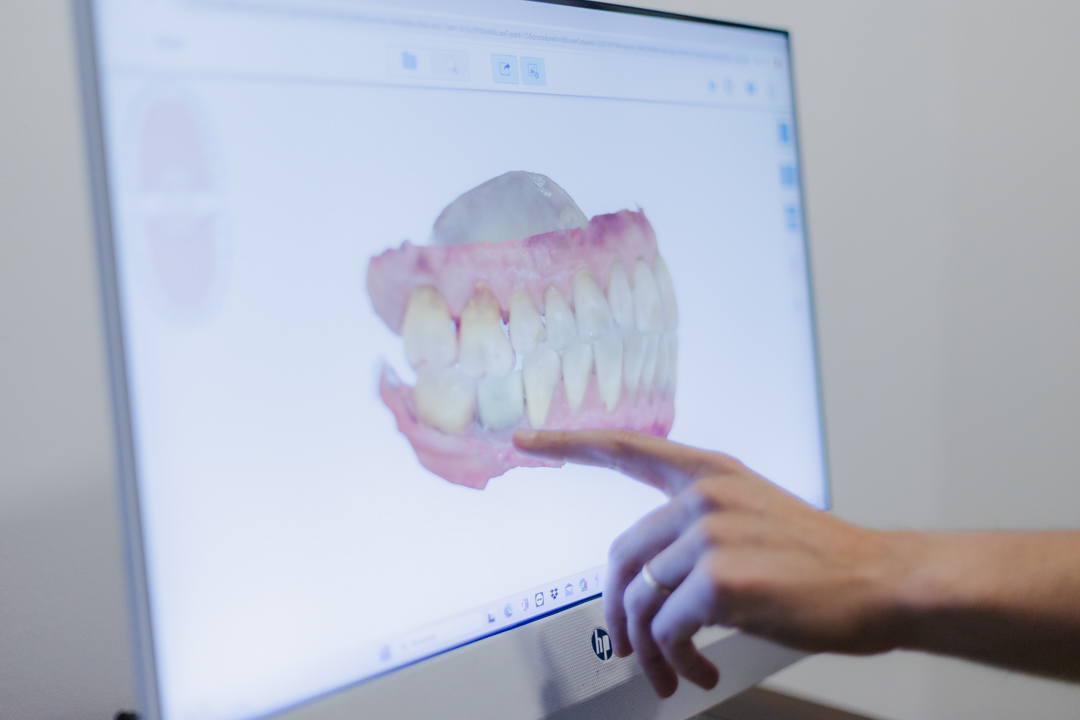 clinica olay dental pola de siero nore&ntilde;a asturias tecnica