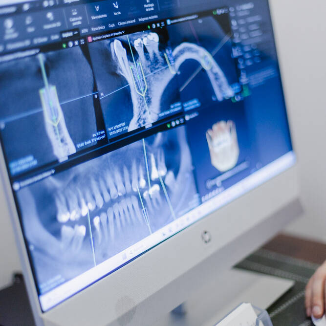 clinica olay dental pola de siero nore&ntilde;a asturias servicios