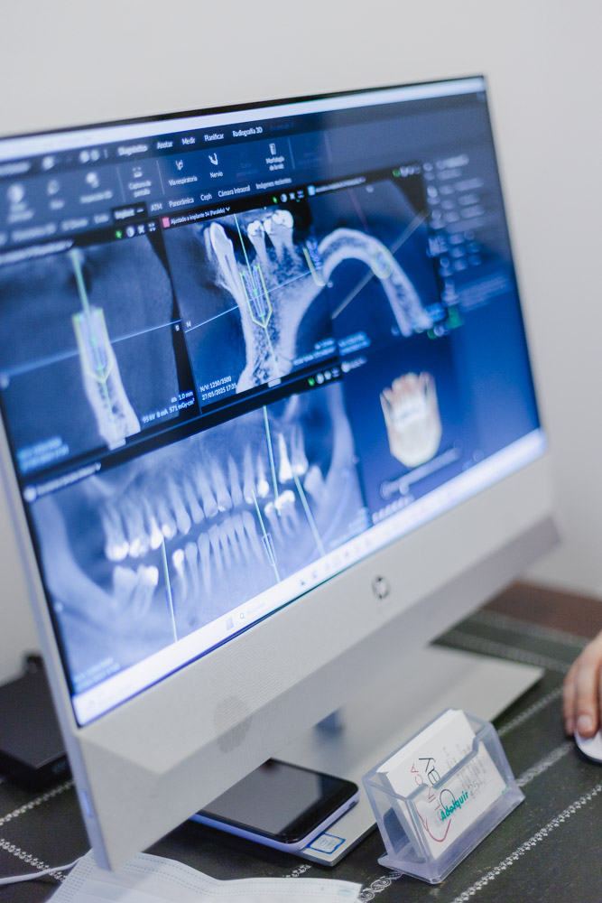 clinica olay dental pola de siero noreña asturias servicios